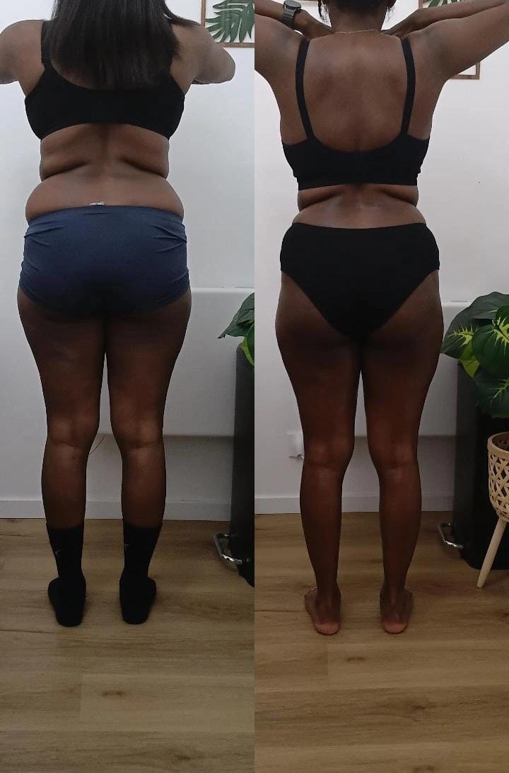 Résultat avant après soin Dianita Massages